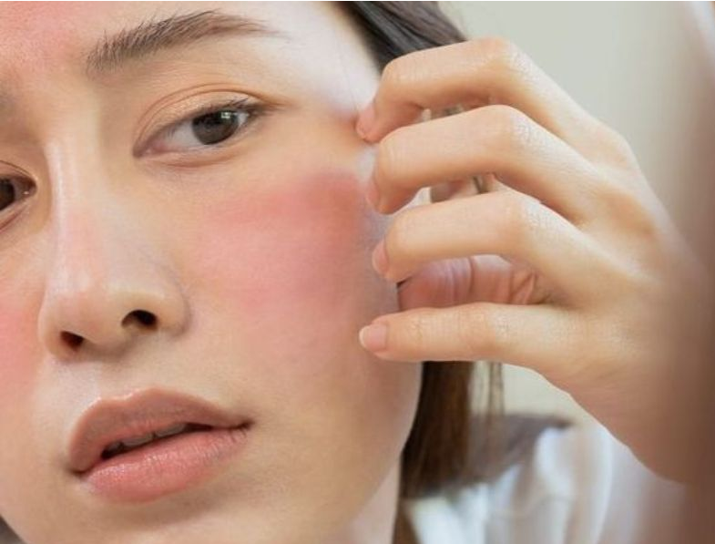 Da nhạy cảm nên tránh những thành phần nào trong serum? Da nhạy cảm nên tránh những thành phần nào trong serum?