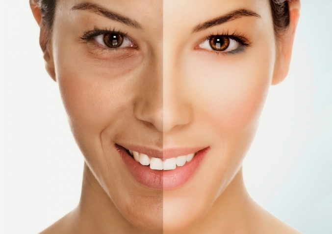 Dấu hiệu nhận biết cơ thể bị thiếu hụt collagen