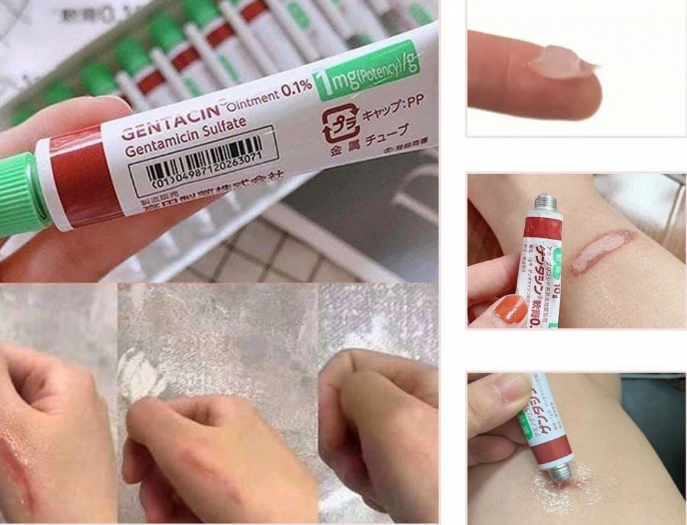 Hướng dẫn sử dụng kem trị sẹo Gentacin của Nhật Bản Hướng dẫn sử dụng kem trị sẹo Gentacin của Nhật Bản
