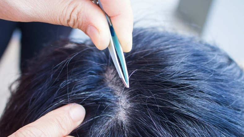 Tóc bạc nhiều do thiếu chất gì? Tóc bạc nhiều do thiếu chất gì?